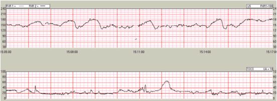 nonstress-test-san-diego-perinatal-center